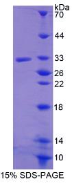 SDS-PAGE (RSPO3-1946H).jpg